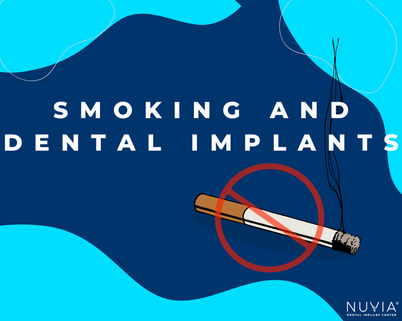 The Effects of Smoking on Allon4 Dental Implants